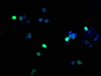 Immunofluorescence staining of HepG2 cells with Phospho-HIST1H1B (S17) Antibody at 1:100, counter-stained with DAPI. The cells were fixed in 4% formaldehyde, permeabilized using 0.2% Triton X-100 and blocked in 10% normal Goat Serum. The cells were then incubated with the antibody overnight at 4°C. The secondary antibody was Alexa Fluor 488-congugated AffiniPure Goat Anti-Rabbit IgG(H+L).Rabbit anti-Human HIST1H1B Polyclonal Antibody