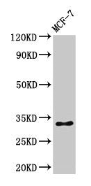 Western Blot  | Positive WB detected in: MCF-7 whole cell lysate  | All lanes: HIST1H1B antibody at 1µg/ml  | Secondary  | Goat polyclonal to rabbit IgG at 1/50000 dilution  | Predicted band size: 23 kDa  | Observed band size: 32 kDaRabbit anti-Human HIST1H1B Polyclonal Antibody
