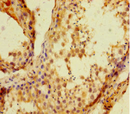 Immunohistochemistry of paraffin-embedded human testis tissue using HIST1H1C Antibody at dilution of 1:100Rabbit anti-Human HIST1H1C Polyclonal Antibody