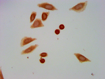 Immunocytochemistry analysis of Formyl-HIST1H1C (K109) Antibody diluted at 1:20 and staining in Hela cells (treated with 30mM sodium butyrate for 4h) performed on a Leica BondTM system. The cells were fixed in 4% formaldehyde, permeabilized using 0.2% Triton X-100 and blocked with 10% normal goat serum 30min at RT. Then primary antibody (1% BSA) was incubated at 4°C overnight. The primary is detected by a biotinylated secondary antibody and visualized using an HRP conjugated SP system.Rabbit anti-Human HIST1H1C Polyclonal Antibody