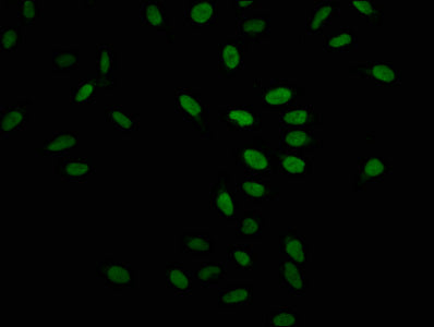 Immunofluorescence staining of Hela cells with Formyl-HIST1H1C (K109) Antibody at 1:20, counter-stained with DAPI. The cells were fixed in 4% formaldehyde, permeabilized using 0.2% Triton X-100 and blocked in 10% normal Goat Serum. The cells were then incubated with the antibody overnight at 4°C. The secondary antibody was Alexa Fluor 488-congugated AffiniPure Goat Anti-Rabbit IgG(H+L).Rabbit anti-Human HIST1H1C Polyclonal Antibody