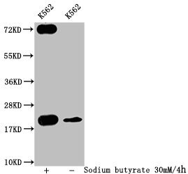 Western Blot  | Detected samples: K562 whole cell lysate; Untreated (-) or treated (+) with 30mM sodium butyrate for 4h  | All lanes: HIST1H1C antibody at 1:400  | Secondary  | Goat polyclonal to rabbit IgG at 1/50000 dilution  | Predicted band size: 22 kDa  | Observed band size: 22 kDaRabbit anti-Human HIST1H1C Polyclonal Antibody