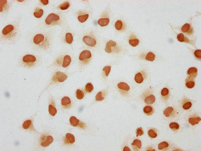 Immunocytochemistry analysis of 2-hydroxyisobutyryl-HIST1H1C (K109) Antibody diluted at 1:50 and staining in Hela cells (treated with 30mM sodium butyrate for 4h) performed on a Leica BondTM system. The cells were fixed in 4% formaldehyde, permeabilized using 0.2% Triton X-100 and blocked with 10% normal goat serum 30min at RT. Then primary antibody (1% BSA) was incubated at 4°C overnight. The primary is detected by a biotinylated secondary antibody and visualized using an HRP conjugated SP system.Rabbit anti-Human HIST1H1C Polyclonal Antibody