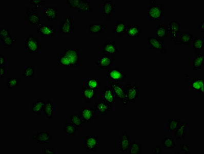Immunofluorescence staining of Hela cells (treated with 30mM sodium butyrate for 4h) with 2-hydroxyisobutyryl-HIST1H1C (K109) Antibody at 1:25, counter-stained with DAPI. The cells were fixed in 4% formaldehyde, permeabilized using 0.2% Triton X-100 and blocked in 10% normal Goat Serum. The cells were then incubated with the antibody overnight at 4°C. The secondary antibody was Alexa Fluor 488-congugated AffiniPure Goat Anti-Rabbit IgG(H+L).Rabbit anti-Human HIST1H1C Polyclonal Antibody