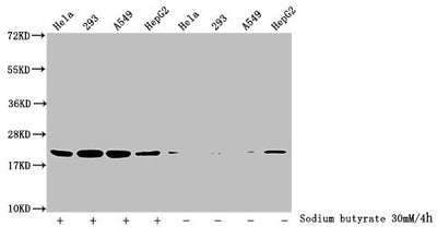 Western Blot  | Detected samples: Hela whole cell lysate, 293 whole cell lysate, A549 whole cell lysate, HepG2 whole cell lysate; Untreated (-) or treated (+) with 30mM sodium butyrate for 4h  | All lanes: HIST1H1C antibody at 3.5µg/ml  | Secondary  | Goat polyclonal to rabbit IgG at 1/50000 dilution  | Predicted band size: 22 kDa  | Observed band size: 22 kDaRabbit anti-Human HIST1H1C Polyclonal Antibody