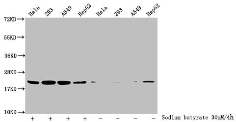 Western Blot  | Detected samples: Hela whole cell lysate, 293 whole cell lysate, A549 whole cell lysate, HepG2 whole cell lysate; Untreated (-) or treated (+) with 30mM sodium butyrate for 4h  | All lanes: HIST1H1C antibody at 3.5µg/ml  | Secondary  | Goat polyclonal to rabbit IgG at 1/50000 dilution  | Predicted band size: 22 kDa  | Observed band size: 22 kDaRabbit anti-Human HIST1H1C Polyclonal Antibody
