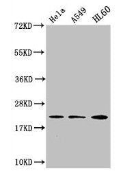 Western Blot  | Positive WB detected in: Hela whole cell lysate, A549 whole cell lysate, HL60 whole cell lysate  | All lanes: HIST1H1C antibody at 1:500  | Secondary  | Goat polyclonal to rabbit IgG at 1/40000 dilution  | Predicted band size: 22 kDa  | Observed band size: 22 kDaRabbit anti-Human HIST1H1C Polyclonal Antibody