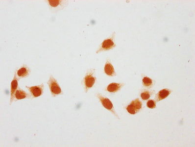 Immunocytochemistry analysis of the antibody diluted at 1:50 and staining in Hela cells (treated with 30mM sodium butyrate for 4h) performed on a Leica BondTM system. The cells were fixed in 4% formaldehyde, permeabilized using 0.2% Triton X-100 and blocked with 10% normal goat serum 30min at RT. Then primary antibody (1% BSA) was incubated at 4°C overnight. The primary is detected by a biotinylated secondary antibody and visualized using an HRP conjugated SP system.Rabbit anti-Human HIST1H1C Polyclonal Antibody