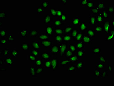 Immunofluorescence staining of Hela cells (treated with 30mM sodium butyrate for 4h) with 2-hydroxyisobutyryl-HIST1H1C (K116) Antibody at 1:25, counter-stained with DAPI. The cells were fixed in 4% formaldehyde, permeabilized using 0.2% Triton X-100 and blocked in 10% normal Goat Serum. The cells were then incubated with the antibody overnight at 4°C. The secondary antibody was Alexa Fluor 488-congugated AffiniPure Goat Anti-Rabbit IgG(H+L).Rabbit anti-Human HIST1H1C Polyclonal Antibody