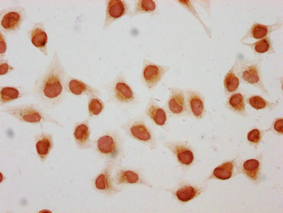 Immunocytochemistry analysis of 2-hydroxyisobutyryl-HIST1H1C (K158) Antibody diluted at 1:10 and staining in Hela cells (treated with 30mM sodium butyrate for 4h) performed on a Leica BondTM system. The cells were fixed in 4% formaldehyde, permeabilized using 0.2% Triton X-100 and blocked with 10% normal goat serum 30min at RT. Then primary antibody (1% BSA) was incubated at 4°C overnight. The primary is detected by a biotinylated secondary antibody and visualized using an HRP conjugated SP system.Rabbit anti-Human HIST1H1C Polyclonal Antibody