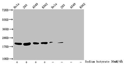 Western Blot  | Detected samples: Hela whole cell lysate, 293 whole cell lysate, A549 whole cell lysate, K562 whole cell lysate; Untreated (-) or treated (+) with 30mM sodium butyrate for 4h  | All lanes: HIST1H1C antibody at 1:100  | Secondary  | Goat polyclonal to rabbit IgG at 1/50000 dilution  | Predicted band size: 22 kDa  | Observed band size: 22 kDaRabbit anti-Human HIST1H1C Polyclonal Antibody