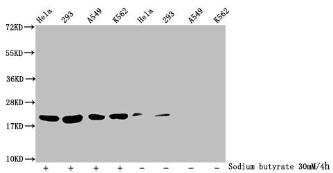Western Blot  | Detected samples: Hela whole cell lysate, 293 whole cell lysate, A549 whole cell lysate, K562 whole cell lysate; Untreated (-) or treated (+) with 30mM sodium butyrate for 4h  | All lanes: HIST1H1C antibody at 1:100  | Secondary  | Goat polyclonal to rabbit IgG at 1/50000 dilution  | Predicted band size: 22 kDa  | Observed band size: 22 kDaRabbit anti-Human HIST1H1C Polyclonal Antibody
