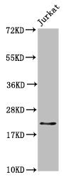 Western Blot  | Positive WB detected in: Jurkat whole cell lysate  | All lanes: HIST1H1C antibody at 1.7µg/ml  | Secondary  | Goat polyclonal to rabbit IgG at 1/50000 dilution  | Predicted band size: 22 kDa  | Observed band size: 22 kDaRabbit anti-Human HIST1H1C Polyclonal Antibody