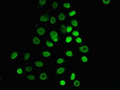 Immunofluorescence staining of A549 cells with HIST1H1C (Ab-25) Antibody at 1:1, counter-stained with DAPI. The cells were fixed in 4% formaldehyde, permeabilized using 0.2% Triton X-100 and blocked in 10% normal Goat Serum. The cells were then incubated with the antibody overnight at 4°C. The secondary antibody was Alexa Fluor 488-congugated AffiniPure Goat Anti-Rabbit IgG(H+L).Rabbit anti-Human HIST1H1C Polyclonal Antibody