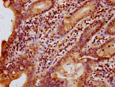IHC image of the antibody diluted at 1:10 and staining in paraffin-embedded human small intestine tissue performed on a Leica BondTM system. After dewaxing and hydration, antigen retrieval was mediated by high pressure in a citrate buffer (pH 6.0). Section was blocked with 10% normal goat serum 30min at RT. Then primary antibody (1% BSA) was incubated at 4°C overnight. The primary is detected by a biotinylated secondary antibody and visualized using an HRP conjugated SP system.Rabbit anti-Human HIST1H1C Polyclonal Antibody