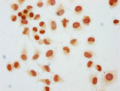 Immunocytochemistry analysis of Mono-methyl-HIST1H1C (K45) Antibody diluted at 1:25 and staining in Hela cells performed on a Leica BondTM system. The cells were fixed in 4% formaldehyde, permeabilized using 0.2% Triton X-100 and blocked with 10% normal goat serum 30min at RT. Then primary antibody (1% BSA) was incubated at 4°C overnight. The primary is detected by a biotinylated secondary antibody and visualized using an HRP conjugated SP system.Rabbit anti-Human HIST1H1C Polyclonal Antibody