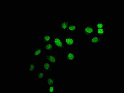 Immunofluorescence staining of Hela cells with Mono-methyl-HIST1H1C (K45) Antibody at 1:12.5, counter-stained with DAPI. The cells were fixed in 4% formaldehyde, permeabilized using 0.2% Triton X-100 and blocked in 10% normal Goat Serum. The cells were then incubated with the antibody overnight at 4°C. The secondary antibody was Alexa Fluor 488-congugated AffiniPure Goat Anti-Rabbit IgG(H+L).Rabbit anti-Human HIST1H1C Polyclonal Antibody