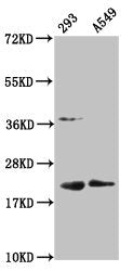 Western Blot  | Positive WB detected in: 293 whole cell lysate, A549 whole cell lysate  | All lanes: HIST1H1C antibody at 1:100  | Secondary  | Goat polyclonal to rabbit IgG at 1/50000 dilution  | Predicted band size: 22 kDa  | Observed band size: 22 kDaRabbit anti-Human HIST1H1C Polyclonal Antibody