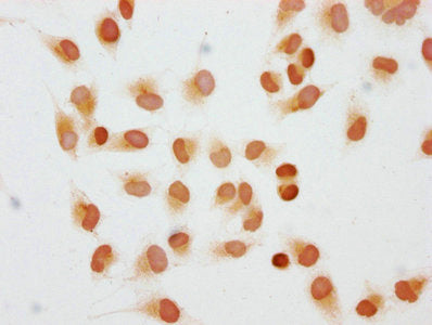 Immunocytochemistry analysis of Di-methyl-HIST1H1C (K45) Antibody diluted at 1:10 and staining in Hela cells performed on a Leica BondTM system. The cells were fixed in 4% formaldehyde, permeabilized using 0.2% Triton X-100 and blocked with 10% normal goat serum 30min at RT. Then primary antibody (1% BSA) was incubated at 4°C overnight. The primary is detected by a biotinylated secondary antibody and visualized using an HRP conjugated SP system.Rabbit anti-Human HIST1H1C Polyclonal Antibody