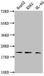 Western Blot  | Positive WB detected in: HepG2 whole cell lysate, K562 whole cell lysate, HL60 whole cell lysate  | All lanes: HIST1H1C antibody at 1:2000  | Secondary  | Goat polyclonal to rabbit IgG at 1/40000 dilution  | Predicted band size: 22 kDa  | Observed band size: 22 kDaRabbit anti-Human HIST1H1C Polyclonal Antibody