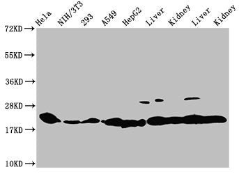 Western Blot  | Positive WB detected in: Hela whole cell lysate, NIH/3T3 whole cell lysate, 293 whole cell lysate, A549 whole cell lysate, HepG2 whole cell lysate, Rat liver tissue, Rat kidney tissue, Mouse liver tissue, Mouse kidney tissue  | All lanes: HIST1H1C antibody at 1:100  | Secondary  | Goat polyclonal to rabbit IgG at 1/50000 dilution  | Predicted band size: 22 kDa  | Observed band size: 22 kDaRabbit anti-Human HIST1H1C Polyclonal Antibody