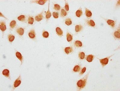 Immunocytochemistry analysis of Acetyl-HIST1H1C (K84) Antibody diluted at 1:5 and staining in Hela cells (treated with 30mM sodium butyrate for 4h) performed on a Leica BondTM system. The cells were fixed in 4% formaldehyde, permeabilized using 0.2% Triton X-100 and blocked with 10% normal goat serum 30min at RT. Then primary antibody (1% BSA) was incubated at 4°C overnight. The primary is detected by a biotinylated secondary antibody and visualized using an HRP conjugated SP system.Rabbit anti-Human HIST1H1C Polyclonal Antibody