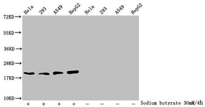 Western Blot  | Detected samples: Hela whole cell lysate, 293 whole cell lysate, A549 whole cell lysate, HepG2 whole cell lysate; Untreated (-) or treated (+) with 30mM sodium butyrate for 4h  | All lanes: HIST1H1C antibody at 2.6µg/ml  | Secondary  | Goat polyclonal to rabbit IgG at 1/50000 dilution  | Predicted band size: 22 kDa  | Observed band size: 22 kDaRabbit anti-Human HIST1H1C Polyclonal Antibody