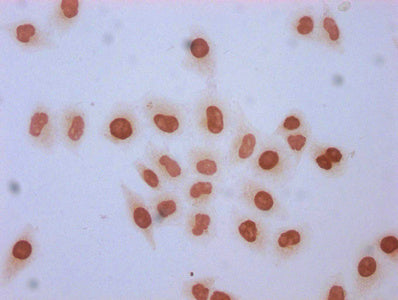 Immunocytochemistry analysis of Formyl-HIST1H1C (K96) Antibody diluted at 1:5 and staining in Hela cells (treated with 30mM sodium butyrate for 4h) performed on a Leica BondTM system. The cells were fixed in 4% formaldehyde, permeabilized using 0.2% Triton X-100 and blocked with 10% normal goat serum 30min at RT. Then primary antibody (1% BSA) was incubated at 4°C overnight. The primary is detected by a biotinylated secondary antibody and visualized using an HRP conjugated SP system.Rabbit anti-Human HIST1H1C Polyclonal Antibody