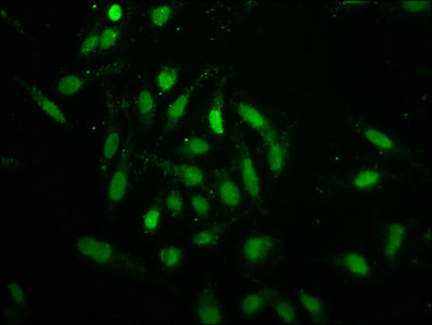 Immunofluorescence staining of Hela cells with Formyl-HIST1H1C (K96) Antibody at 1:2.5, counter-stained with DAPI. The cells were fixed in 4% formaldehyde, permeabilized using 0.2% Triton X-100 and blocked in 10% normal Goat Serum. The cells were then incubated with the antibody overnight at 4°C. The secondary antibody was Alexa Fluor 488-congugated AffiniPure Goat Anti-Rabbit IgG(H+L).Rabbit anti-Human HIST1H1C Polyclonal Antibody