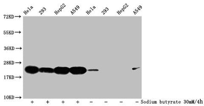 Western Blot  | Detected samples: Hela whole cell lysate, 293 whole cell lysate, HepG2 whole cell lysate, A549 whole cell lysate; Untreated (-) or treated (+) with 30mM sodium butyrate for 4h  | All lanes: HIST1H1C antibody at 1:500  | Secondary  | Goat polyclonal to rabbit IgG at 1/40000 dilution  | Predicted band size: 22 kDa  | Observed band size: 22 kDaRabbit anti-Human HIST1H1C Polyclonal Antibody
