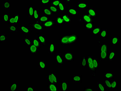 Immunofluorescence staining of Hela cells with Mono-methyl-HIST1H1C (K96) Antibody at 1:15, counter-stained with DAPI. The cells were fixed in 4% formaldehyde, permeabilized using 0.2% Triton X-100 and blocked in 10% normal Goat Serum. The cells were then incubated with the antibody overnight at 4°C. The secondary antibody was Alexa Fluor 488-congugated AffiniPure Goat Anti-Rabbit IgG(H+L).Rabbit anti-Human HIST1H1C Polyclonal Antibody