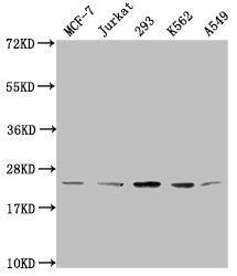 Western Blot  | Positive WB detected in: MCF-7 whole cell lysate, Jurkat whole cell lysate, 293 whole cell lysate, K562 whole cell lysate, A549 whole cell lysate  | All lanes: HIST1H1C antibody at 1:2000  | Secondary  | Goat polyclonal to rabbit IgG at 1/40000 dilution  | Predicted band size: 22 kDa  | Observed band size: 22 kDaRabbit anti-Human HIST1H1C Polyclonal Antibody