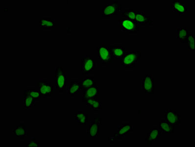 Immunofluorescence staining of Hela cells with HIST1H1C (Ab-96) Antibody at 1:2.5, counter-stained with DAPI. The cells were fixed in 4% formaldehyde, permeabilized using 0.2% Triton X-100 and blocked in 10% normal Goat Serum. The cells were then incubated with the antibody overnight at 4°C. The secondary antibody was Alexa Fluor 488-congugated AffiniPure Goat Anti-Rabbit IgG(H+L).Rabbit anti-Human HIST1H1C Polyclonal Antibody
