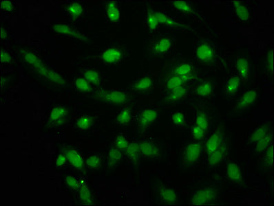Immunofluorescence staining of Hela cells with HIST1H1C (Ab-96) Antibody at 1:2.5, counter-stained with DAPI. The cells were fixed in 4% formaldehyde, permeabilized using 0.2% Triton X-100 and blocked in 10% normal Goat Serum. The cells were then incubated with the antibody overnight at 4°C. The secondary antibody was Alexa Fluor 488-congugated AffiniPure Goat Anti-Rabbit IgG(H+L).Rabbit anti-Human HIST1H1C Polyclonal Antibody