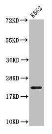 Western Blot  | Positive WB detected in: K562 whole cell lysate  | All lanes: HIST1H1C antibody at 0.48µg/ml  | Secondary  | Goat polyclonal to rabbit IgG at 1/50000 dilution  | Predicted band size: 22 kDa  | Observed band size: 22 kDaRabbit anti-Human HIST1H1C Polyclonal Antibody