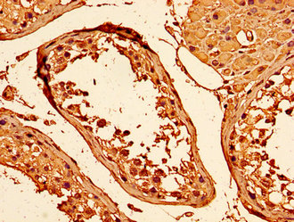 IHC image of HIST1H1C (Ab-96) Antibody diluted at 1:50 and staining in paraffin-embedded human testis tissue performed on a Leica BondTM system. After dewaxing and hydration, antigen retrieval was mediated by high pressure in a citrate buffer (pH 6.0). Section was blocked with 10% normal goat serum 30min at RT. Then primary antibody (1% BSA) was incubated at 4°C overnight. The primary is detected by a biotinylated secondary antibody and visualized using an HRP conjugated SP system.Rabbit anti-Human HIST1H1C Polyclonal Antibody