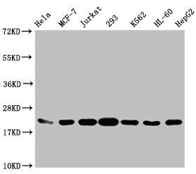 Western Blot  | Positive WB detected in: Hela whole cell lysate, MCF-7 whole cell lysate, Jurkat whole cell lysate, 293 whole cell lysate, K562 whole cell lysate, HL60 whole cell lysate, HepG2 whole cell lysate  | All lanes: HIST1H1C antibody at 1:1000  | Secondary  | Goat polyclonal to rabbit IgG at 1/40000 dilution  | Predicted band size: 22 kDa  | Observed band size: 22 kDaRabbit anti-Human HIST1H1C Polyclonal Antibody