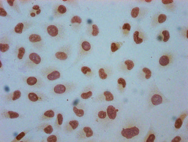 Immunocytochemistry analysis of Crotonyl-HIST1H1C (K158) Antibody diluted at 1:50 and staining in Hela cells (treated with 30mM sodium crotonylate for 4h) performed on a Leica BondTM system. The cells were fixed in 4% formaldehyde, permeabilized using 0.2% Triton X-100 and blocked with 10% normal goat serum 30min at RT. Then primary antibody (1% BSA) was incubated at 4°C overnight. The primary is detected by a biotinylated secondary antibody and visualized using an HRP conjugated SP system.Rabbit anti-Human HIST1H1C Polyclonal Antibody