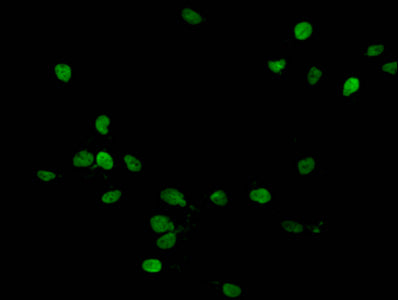 Immunofluorescent analysis of Hela cells (treated with 30mM crotonylate for 4h) using the antibody at dilution of 1:100 and Alexa Fluor 488-congugated AffiniPure Goat Anti-Rabbit IgG(H+L)Rabbit anti-Human HIST1H1C Polyclonal Antibody