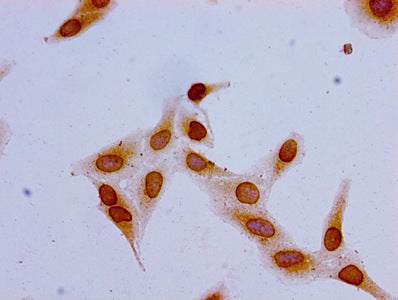 Immunocytochemistry analysis of Hela cells using the antibody at dilution of 1:100Rabbit anti-Human HIST1H1C Polyclonal Antibody