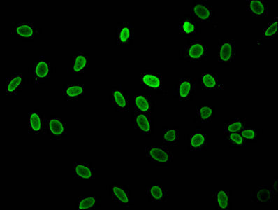 Immunofluorescent analysis of Hela cells (sodium butyrate, 30 mM, 4h) using Acetyl-HIST1H1C (K16) Antibody at dilution of 1:100 and Alexa Fluor 488-congugated AffiniPure Goat Anti-Rabbit IgG(H+L)Rabbit anti-Human HIST1H1C Polyclonal Antibody