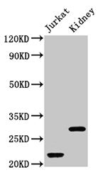 Western Blot  | Positive WB detected in: Jurkat whole cell lysate, Rat kidney tissue  | All lanes: HIST1H1C antibody at 1µg/ml  | Secondary  | Goat polyclonal to rabbit IgG at 1/50000 dilution  | Predicted band size: 22 kDa  | Observed band size: 22, 28 kDaRabbit anti-Human HIST1H1C Polyclonal Antibody