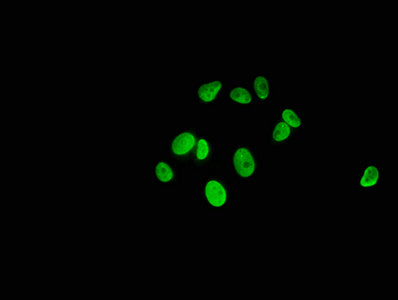 Immunofluorescence staining of MCF-7 cells with Mono-methyl-HIST1H1C (K186) Antibody at 1:5, counter-stained with DAPI. The cells were fixed in 4% formaldehyde, permeabilized using 0.2% Triton X-100 and blocked in 10% normal Goat Serum. The cells were then incubated with the antibody overnight at 4°C. The secondary antibody was Alexa Fluor 488-congugated AffiniPure Goat Anti-Rabbit IgG(H+L).Rabbit anti-Human HIST1H1C Polyclonal Antibody