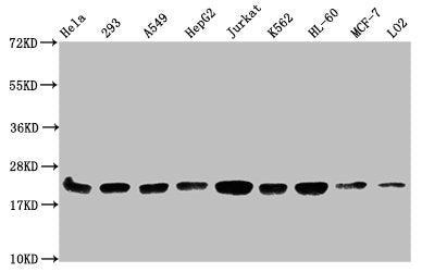 Western Blot  | Positive WB detected in: Hela whole cell lysate, 293 whole cell lysate, A549 whole cell lysate, HepG2 whole cell lysate, Jurkat whole cell lysate, K562 whole cell lysate, HL60 whole cell lysate, MCF-7 whole cell lysate, LO2 whole cell lysate  | All lanes: HIST1H1C antibody at 1:500  | Secondary  | Goat polyclonal to rabbit IgG at 1/40000 dilution  | Predicted band size: 22 kDa  | Observed band size: 22 kDaRabbit anti-Human HIST1H1C Polyclonal Antibody
