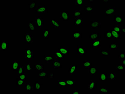 Immunofluorescent analysis of Hela cells (sodium butyrate, 30 mM, 4h) using Acetyl-HIST1H1C (K62) Antibody at dilution of 1:100 and Alexa Fluor 488-congugated AffiniPure Goat Anti-Rabbit IgG(H+L)Rabbit anti-Human HIST1H1C Polyclonal Antibody