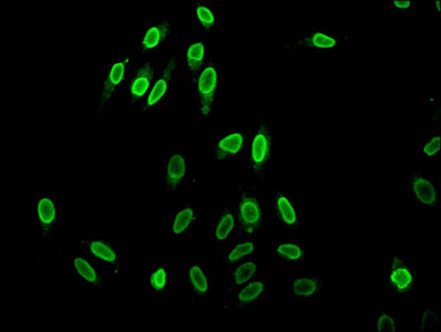 Immunofluorescent analysis of Hela cells (sodium butyrate, 30 mM, 4h) using Acetyl-HIST1H1C (K96) Antibody at dilution of 1:100 and Alexa Fluor 488-congugated AffiniPure Goat Anti-Rabbit IgG(H+L)Rabbit anti-Human HIST1H1C Polyclonal Antibody