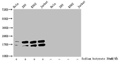 Western Blot  | Detected samples: Hela whole cell lysate, 293 whole cell lysate, K562 whole cell lysate, Jurkat whole cell lysate; Untreated (-) or treated (+) with 30mM sodium butyrate for 4h  | All lanes: HIST1H1C antibody at 1:2000  | Secondary  | Goat polyclonal to rabbit IgG at 1/40000 dilution  | Predicted band size: 22 kDa  | Observed band size: 22 kDaRabbit anti-Human HIST1H1C Polyclonal Antibody