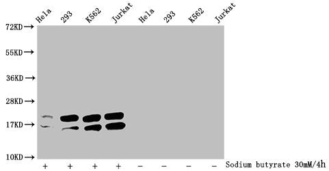 Western Blot  | Detected samples: Hela whole cell lysate, 293 whole cell lysate, K562 whole cell lysate, Jurkat whole cell lysate; Untreated (-) or treated (+) with 30mM sodium butyrate for 4h  | All lanes: HIST1H1C antibody at 1:2000  | Secondary  | Goat polyclonal to rabbit IgG at 1/40000 dilution  | Predicted band size: 22 kDa  | Observed band size: 22 kDaRabbit anti-Human HIST1H1C Polyclonal Antibody
