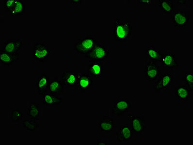 Immunofluorescence staining of Hela cells with HIST1H1D (Ab-90) Antibody at 1:7.5, counter-stained with DAPI. The cells were fixed in 4% formaldehyde, permeabilized using 0.2% Triton X-100 and blocked in 10% normal Goat Serum. The cells were then incubated with the antibody overnight at 4°C. The secondary antibody was Alexa Fluor 488-congugated AffiniPure Goat Anti-Rabbit IgG(H+L).Rabbit anti-Human HIST1H1D Polyclonal Antibody