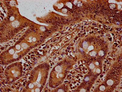IHC image of the antibody diluted at 1:20 and staining in paraffin-embedded human small intestine tissue performed on a Leica BondTM system. After dewaxing and hydration, antigen retrieval was mediated by high pressure in a citrate buffer (pH 6.0). Section was blocked with 10% normal goat serum 30min at RT. Then primary antibody (1% BSA) was incubated at 4°C overnight. The primary is detected by a biotinylated secondary antibody and visualized using an HRP conjugated SP system.Rabbit anti-Human HIST1H1D Polyclonal Antibody